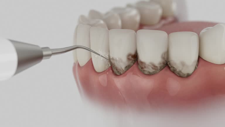 Trusted Dental Implants service in Combee Settlement, FL - Dentist Open Now